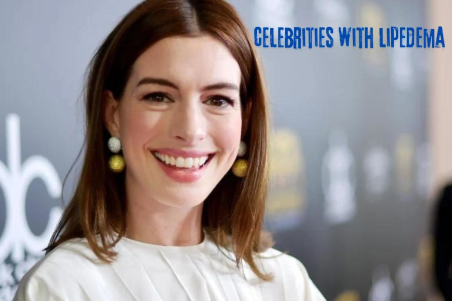 Celebrities With Lipedema: Overcoming Challenges And Inspiring Confidence